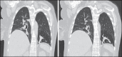 Figure 27