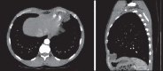 Figure 32