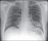 Figure 26