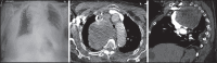 Figure 31