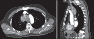 Figure 29