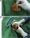 Fig. 3