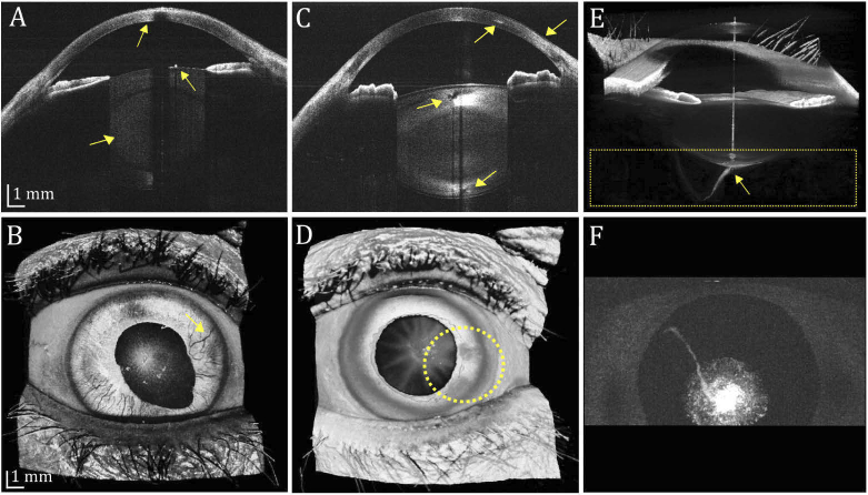 Fig. 10.