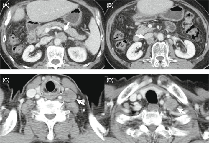 FIGURE 2