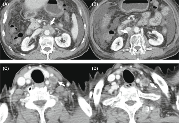 FIGURE 4