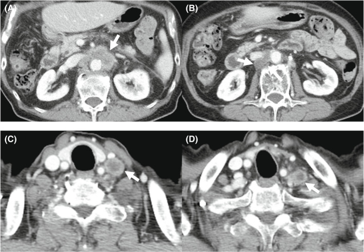 FIGURE 3