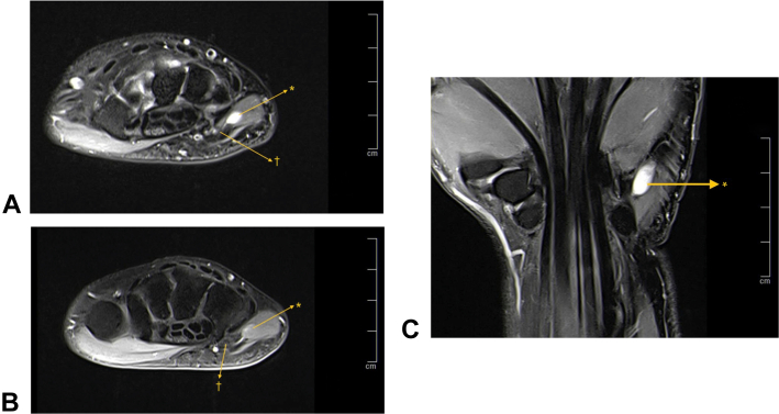 Figure 3