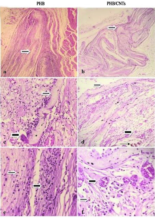 Figure12