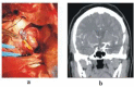 Figure 3a, b: