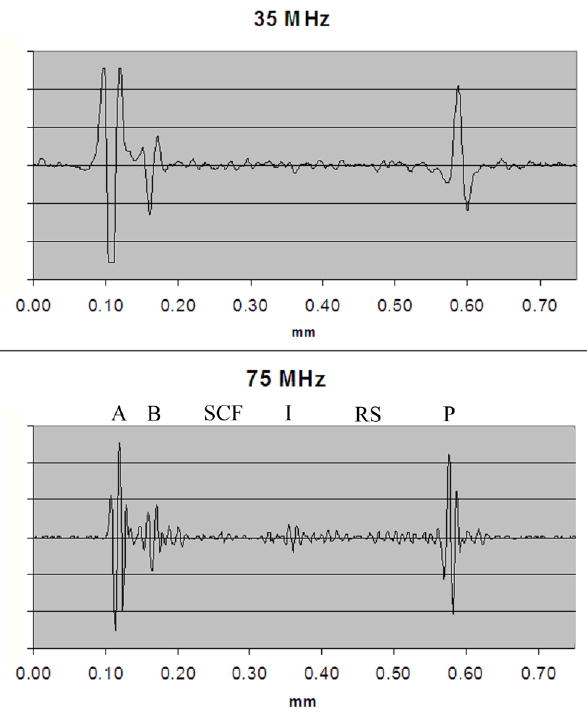 FIG. 5