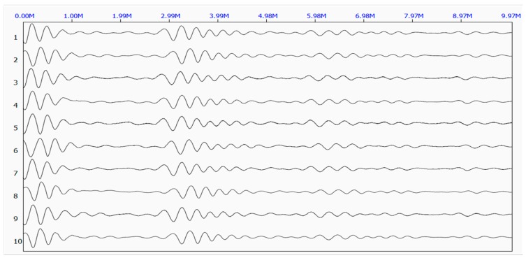 Figure 14