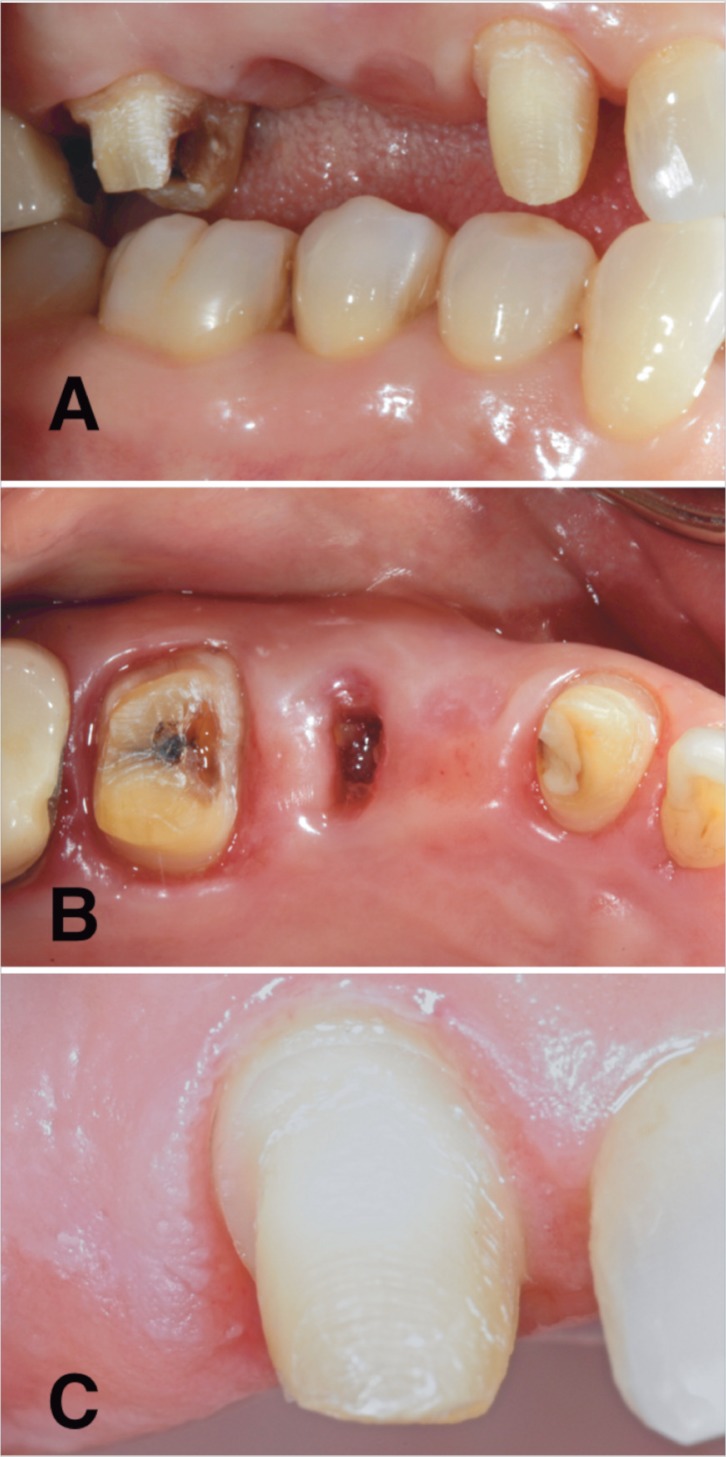 Figure 2 A, B, C