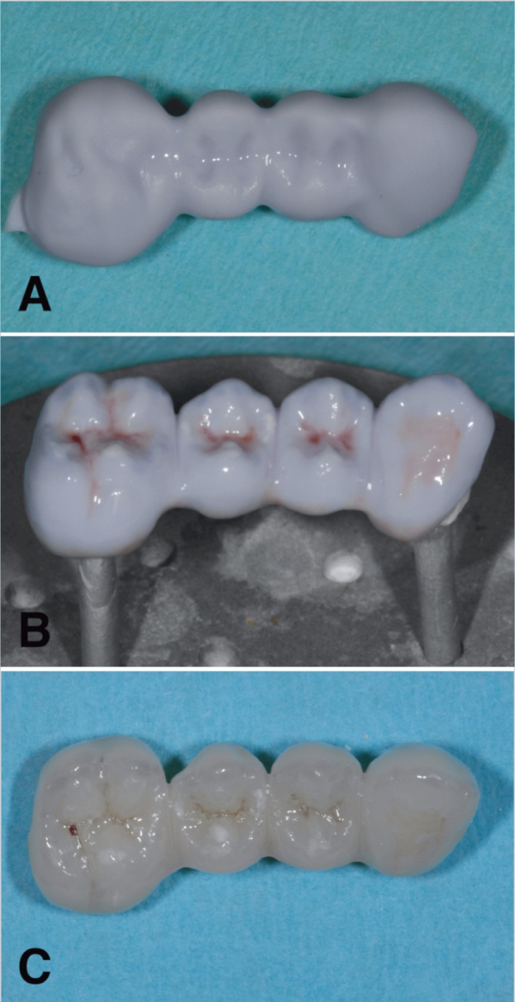 Figure 5 A, B, C