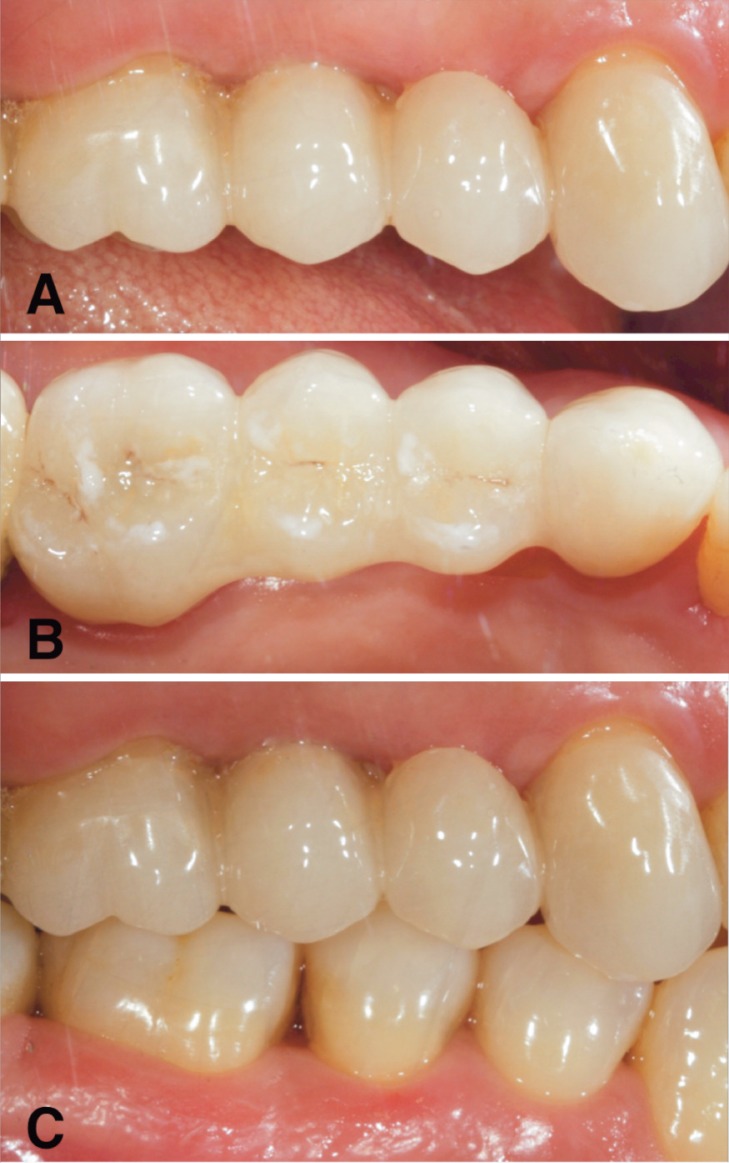 Figure 6 A, B, C