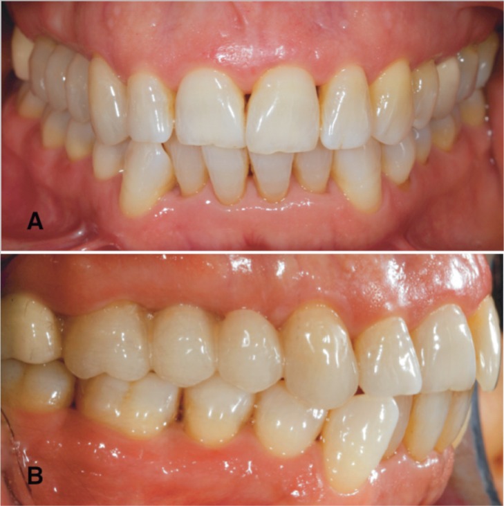 Figure 7 A, B