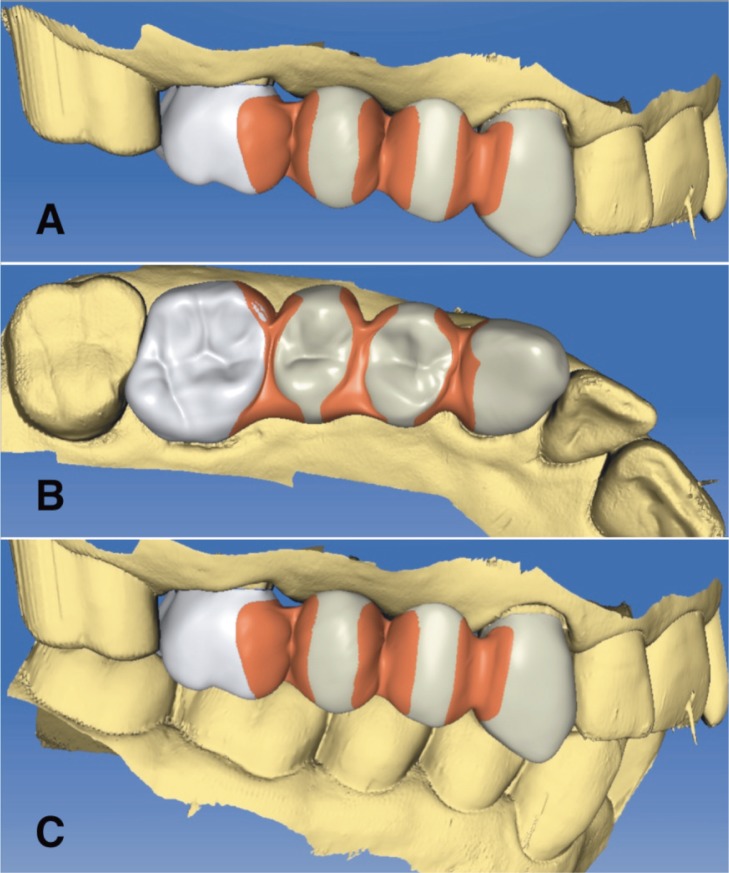 Figure 4 A, B, C