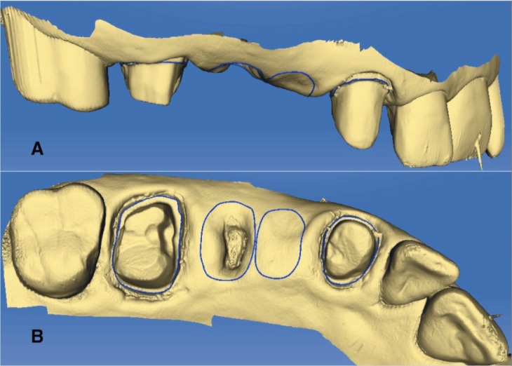 Figure 3 A, B