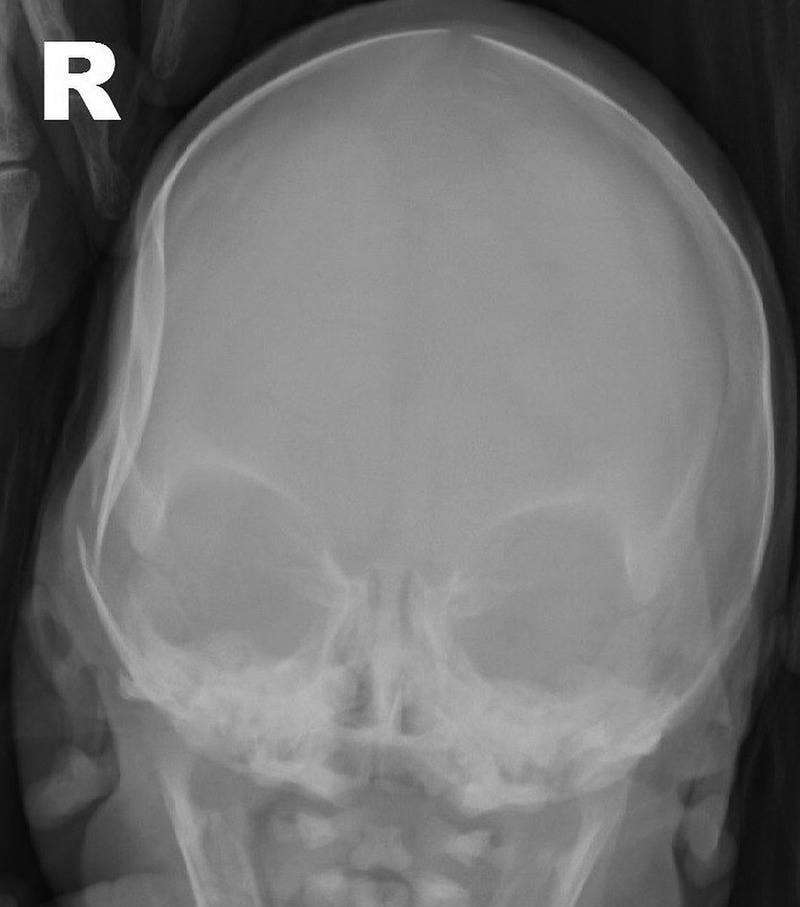Figure 2