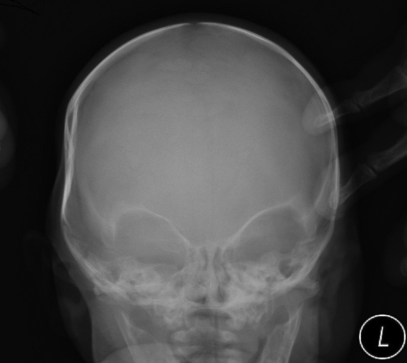 Figure 3