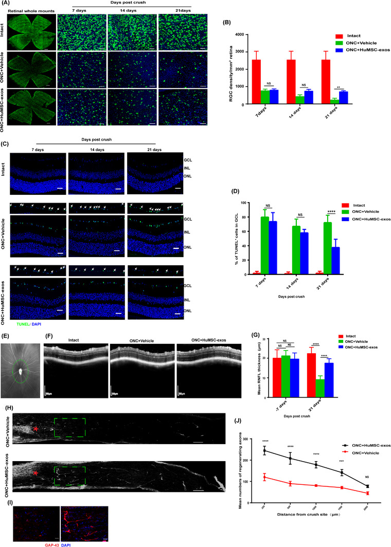 Umbilical Cord Mesenchymal Stem Cell‐derived Exosomes Promote Axon Regeneration During Optic