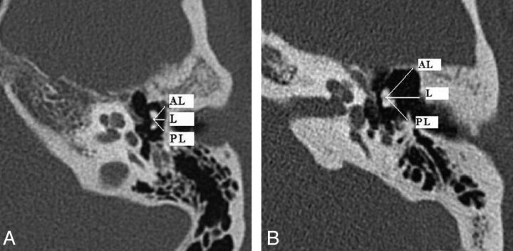 Fig 2.