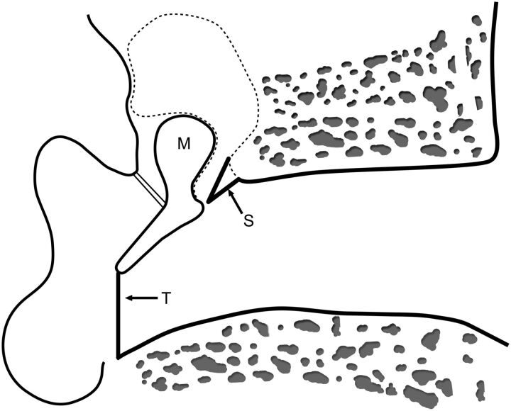 Fig 4.