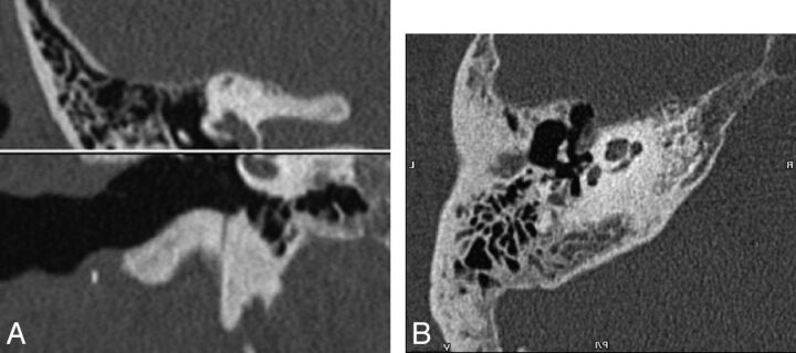 Fig 1.