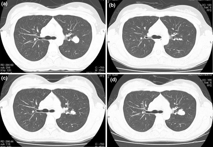 Fig. 2