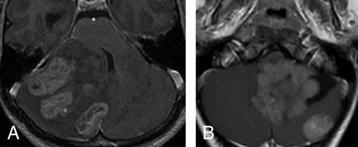 Fig 2.