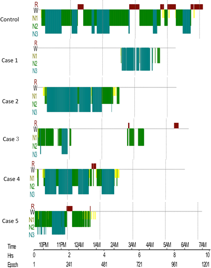 Figure 4