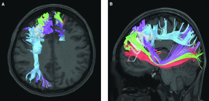 FIGURE 16.