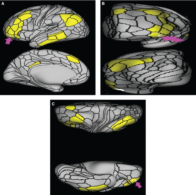 FIGURE 11.