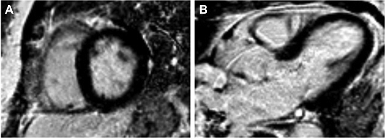 Figure 4