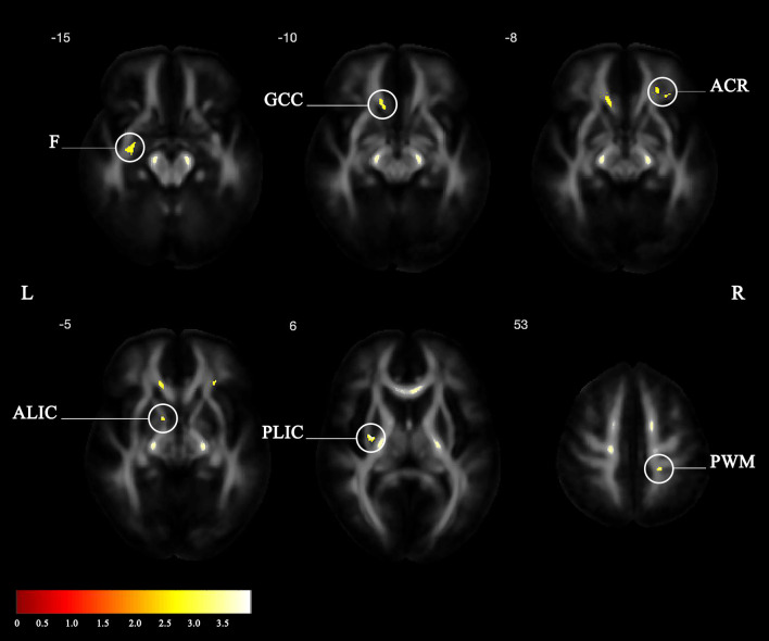 Fig 3