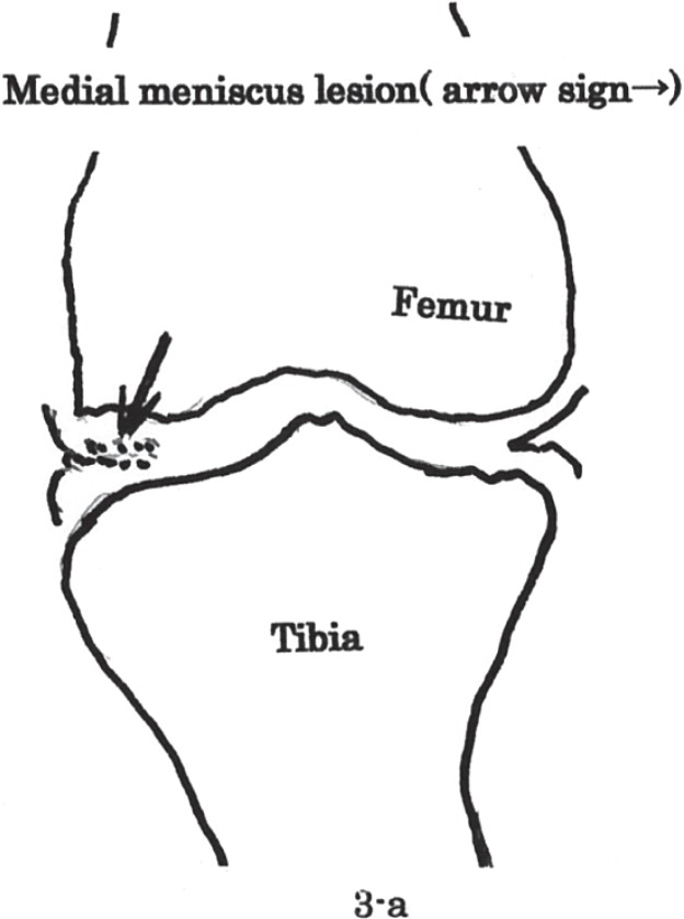 Figure 3-a: