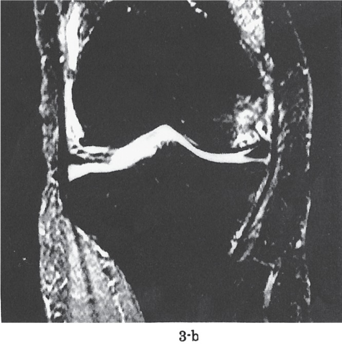 Figure 3-b: