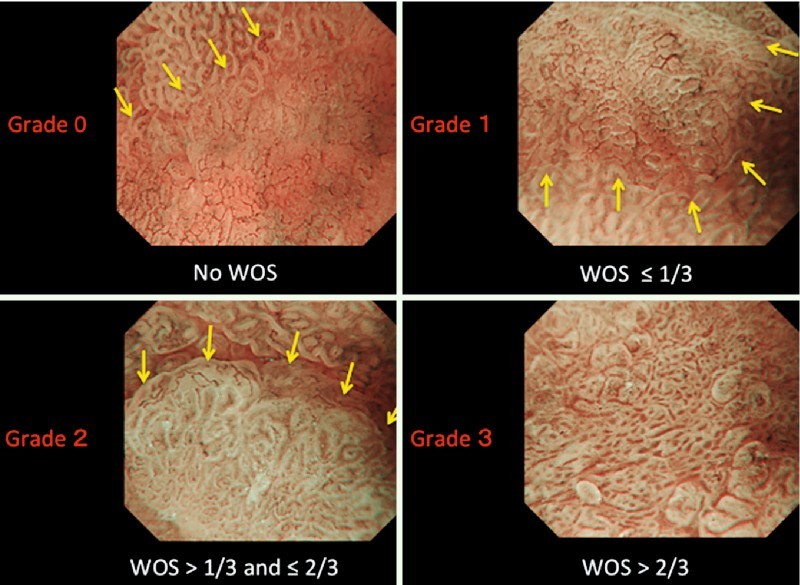 Fig. 1