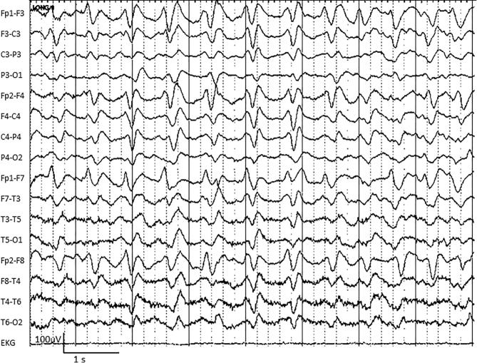 Fig. 4