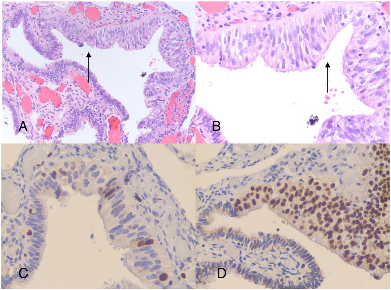 Fig. 1