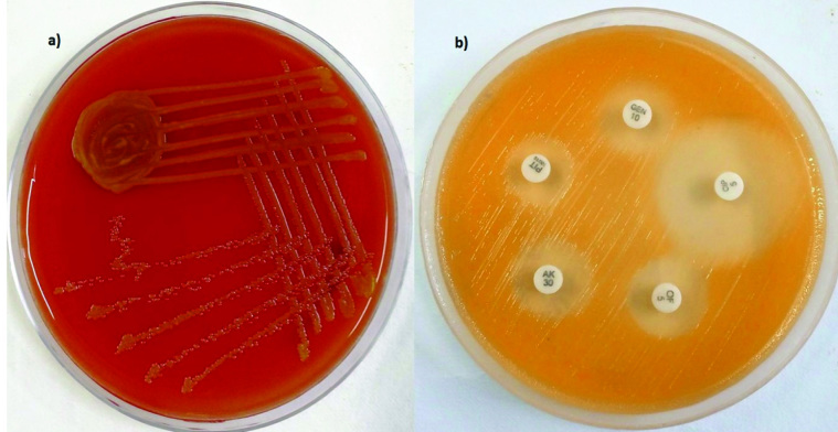 [Table/Fig-1]: