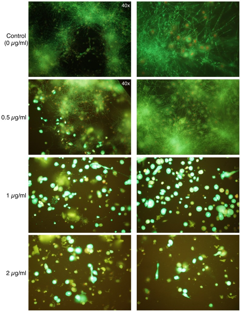 Figure 11