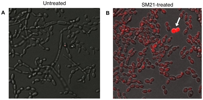 Figure 14