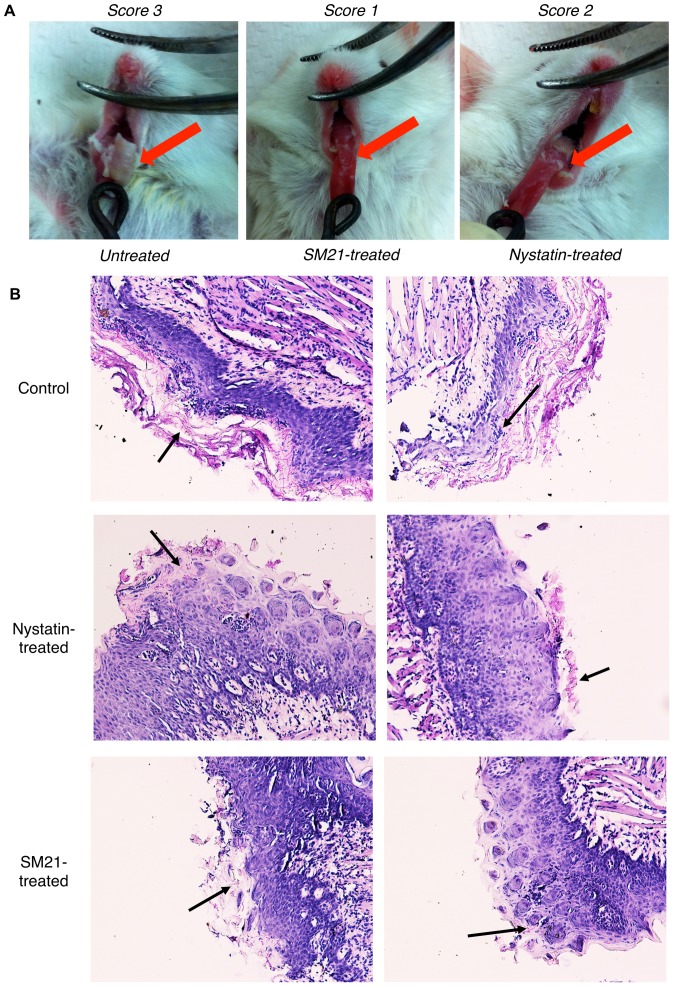 Figure 13