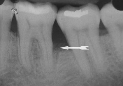 Figure 10b