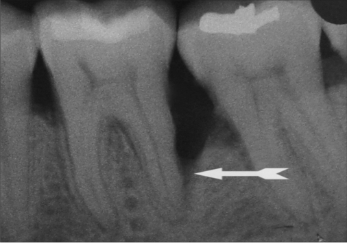 Figure 10a