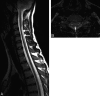 Fig 3.