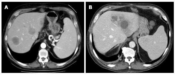 Figure 14