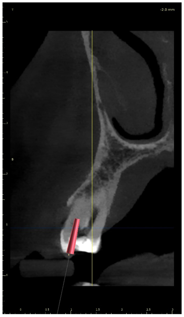 Figure 26