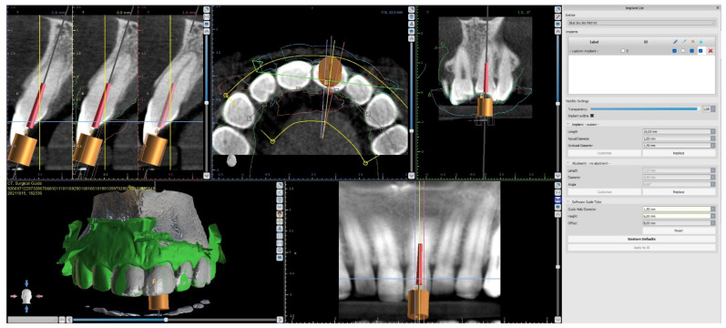 Figure 10