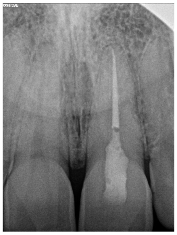 Figure 18